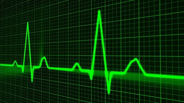 Redefining the Clinical Backbone with Modern Telemetry cover